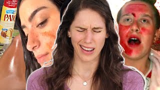 Medical Esthe Reacts To The Most Dangerous Skincare Tik Toks  & Trends