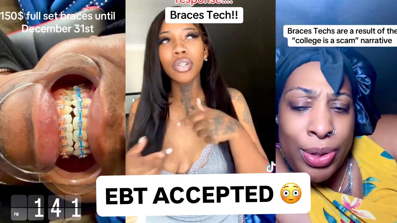 $150 BRACES… IN A BASEMENT?! TIKTOK IS LOSING IT 😳