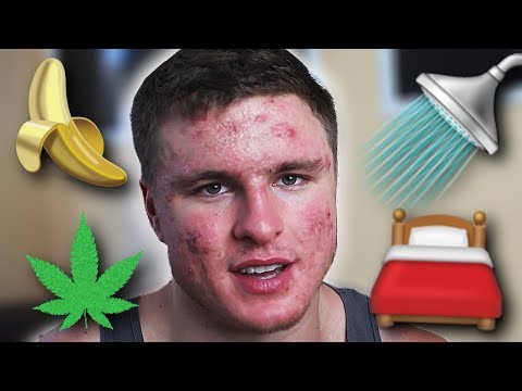 Does THIS Cause Acne? | Weed, Hot Showers, Sleep, Fruits? (EP. )