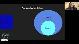 PT and how it relates to Camp No Limits 3/29/22