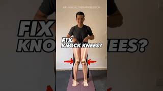 Effective way to fix KNOCK KNEES knockknees kneepain knee kneearthritis kneepainrelief short