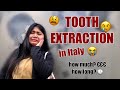 WISDOM TOOTH EXTRACTION | goodbye wisdom tooth 2021 👋 | CHIARA JAYNE