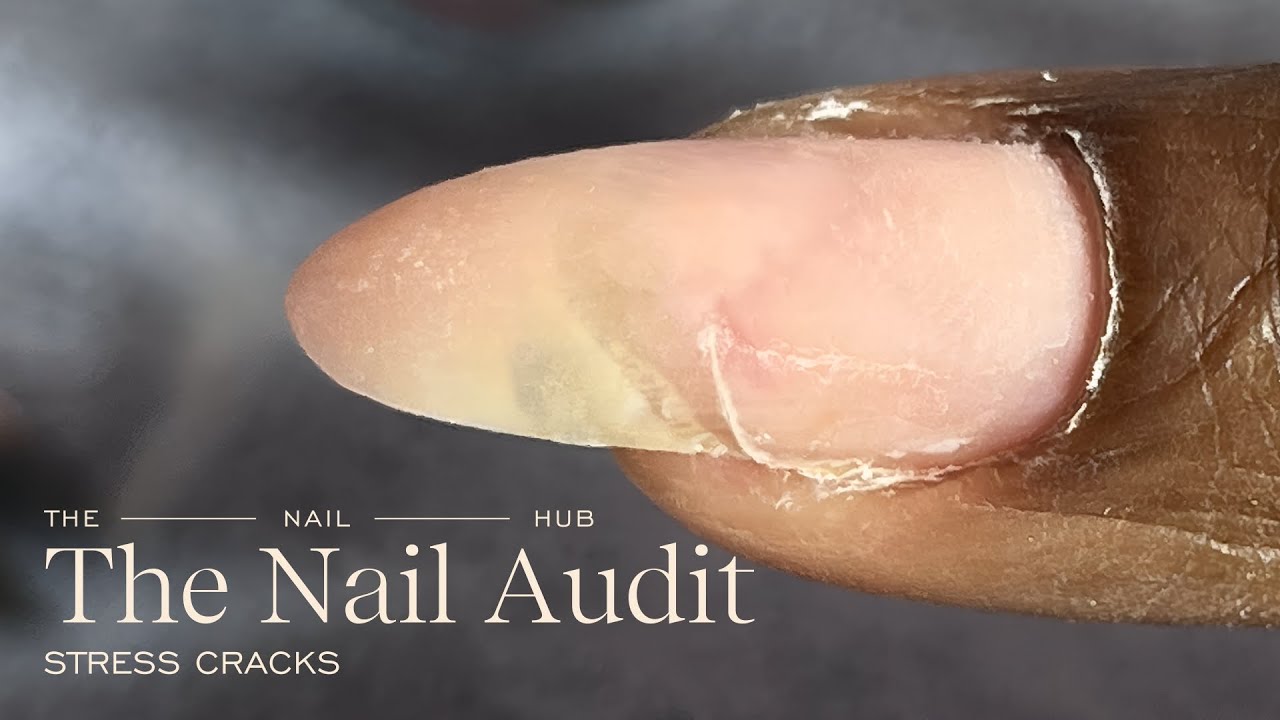 Почему гелевые ногти трескаются и как исправить повреждения от напряжения | Правильная форма и ст...