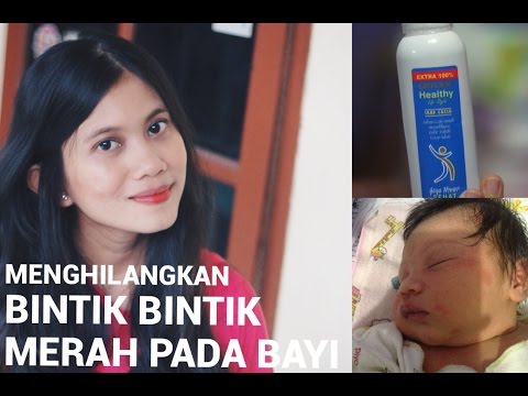 Cara Ubat Ruam Bayi - Num Lock j