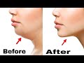 2 Easy Face Exercise To Get Rid Of Double Chin | Doctor Vivek