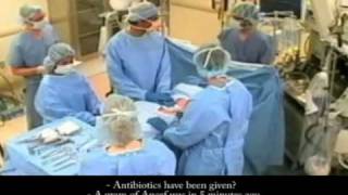 WHO Safe Surgery Saves Lives Checklist Net Worth