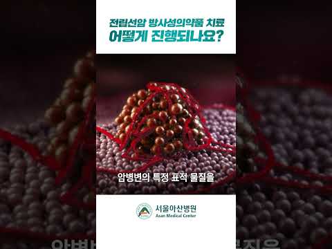 전립선암의 방사성의약품 치료는 어떻게 진행되나요?