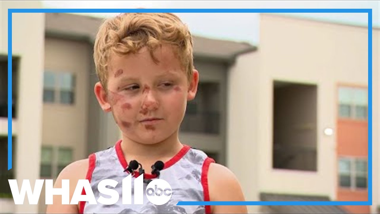 “It just kind of hit me,” an 8-year-old Texas boy said after a hit-and-run