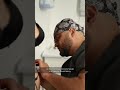 Липоабдоминопластика после похудения со 100 до 60 кг.