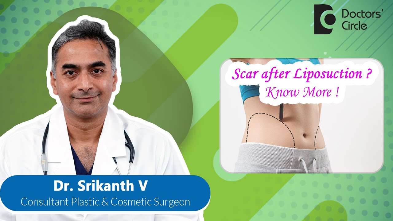 LIPOSUCTION Procedure Scar & Durability plasticsurgery lipo Dr