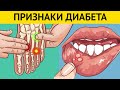 10 ранних признаков того, что у вас ДИАБЕТ. Многие игнорируют эти симптомы. Профилактика диабета