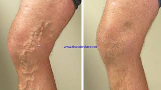 2Nd Year 1St Samester A And C Section Lecture 26 Dr Bilalhimat 1