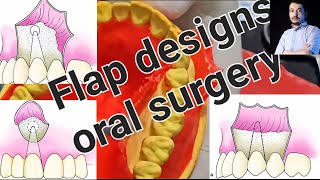 Basic principles of flap ( envelope, trapezoid, triangular and semilunar flaps ) #dentistry #dentist