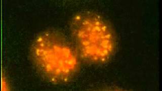 Nucleolus: from structure to dynamics