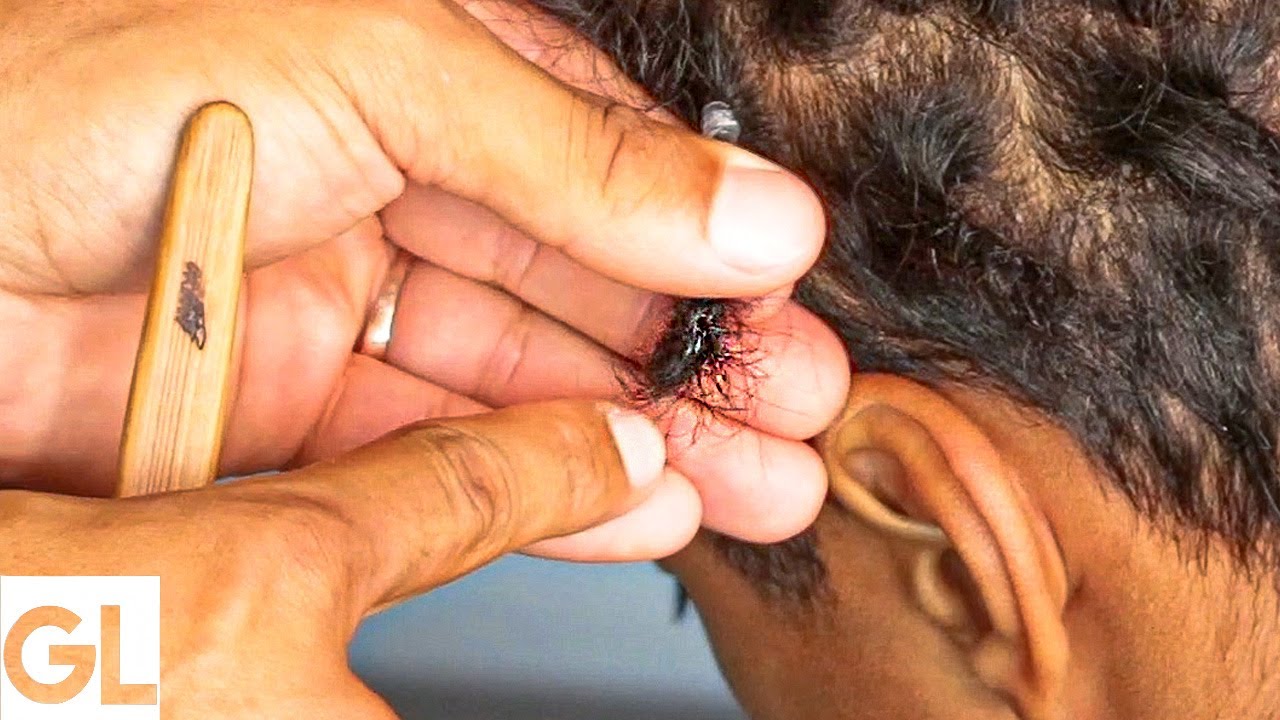 How To Fix Frizzy Dreadlocks