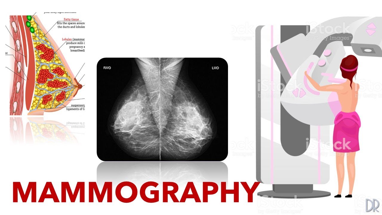 basic-mammography-techniques-youtube