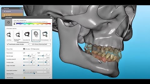How I design a perfect dental crown in Exocad Invisalgin Design Suite (Assisted x Expert Mode).
