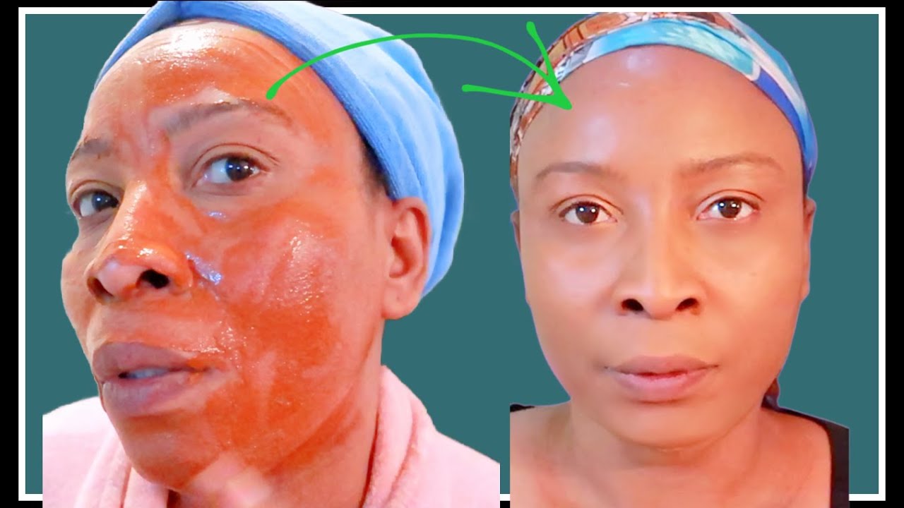 How To Shrink Large Pores Get Rid Of Blackheads Reduce Wrinkles Using how-to-shrink-large-pores-get-rid-of-blackheads-reduce-wrinkles-using