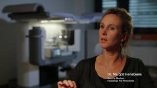 Affirm Prone Breast Biopsy System Testimonial: Dr. Henebiens
