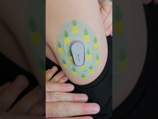 Dexcom Swap Early due to error #diabetes #t1d #dexcom #expressionmed #typeonediabetes #diabadass
