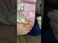 Ingrown toenail partial nail aviation with phenol and alcohol matrixectomy dr jordan stewart