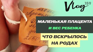 картинка: ЭКО. Гипотрофия плаценты // Обвитие пуповиной //С каким весом родились