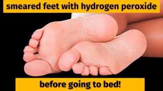 This happened after 2 times! hydrogen peroxide on your feet. Simple and affordable