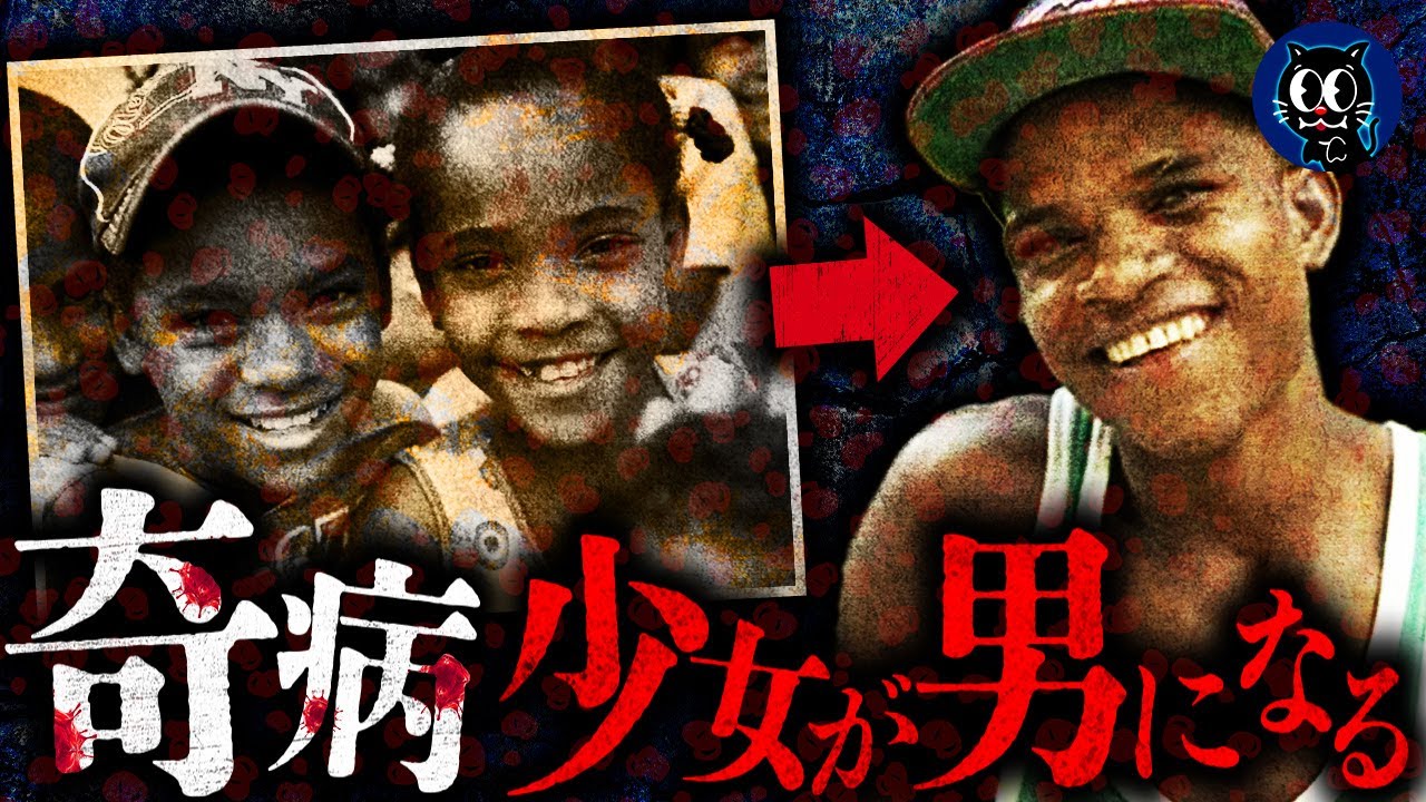 【実話】ある日突然少女が男性に…世界の奇病を紹介