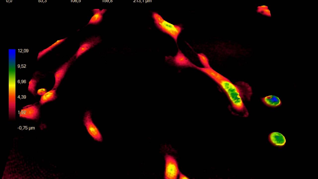 Mammar Inmotion Live MCF10A Human Mammary Epithelial Cell Motion Seen Using The ...