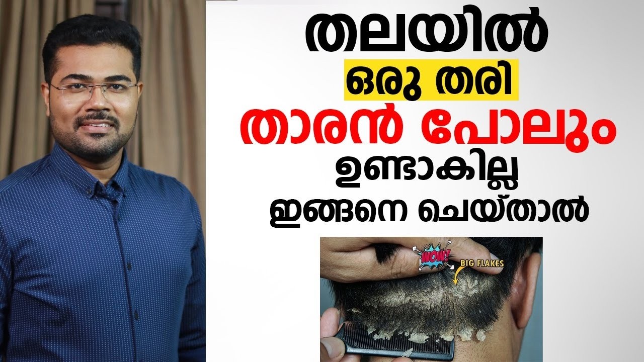 താരൻ പെട്ടെന്ന് മാറും, ഷാമ്പു ഇനി വേണ്ട! ✨ ഞെട്ടിക്കുന്ന കാരണം ഇതാണ് | Dandruff Permanent Cure