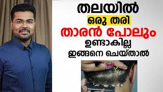 താരൻ പെട്ടെന്ന് മാറും, ഷാമ്പു ഇനി വേണ്ട! ✨ ഞെട്ടിക്കുന്ന കാരണം ഇതാണ് | Dandruff Permanent Cure