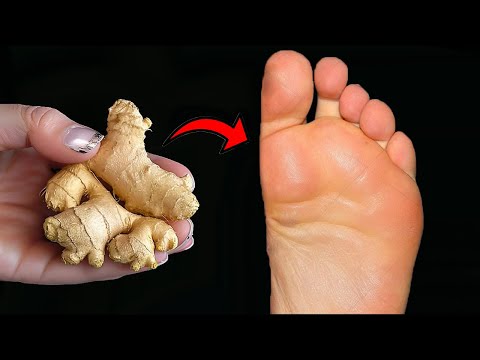 Put ginger on your leg and be amazed at the result! Great natural advice