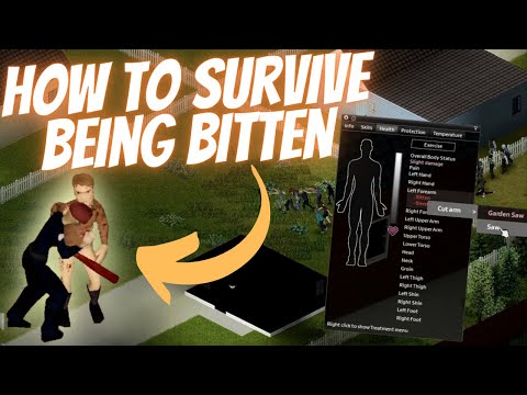 How to Survive a Bite in Project Zomboid