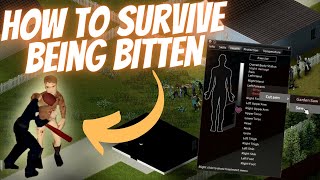 How to Survive a Bite in Project Zomboid