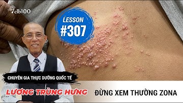 Lesson #307: Đừng xem thường Zona: Một cơn đau có thể theo bạn nhiều năm trời?10-12-2025