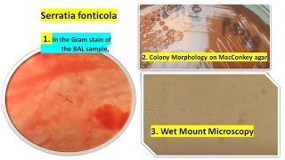 Serratia Colony Morphology, Wet Mount and Gram Staining