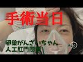 【手術当日】ストーマ閉鎖、人工肛門閉鎖術、当日のリアルな様子です