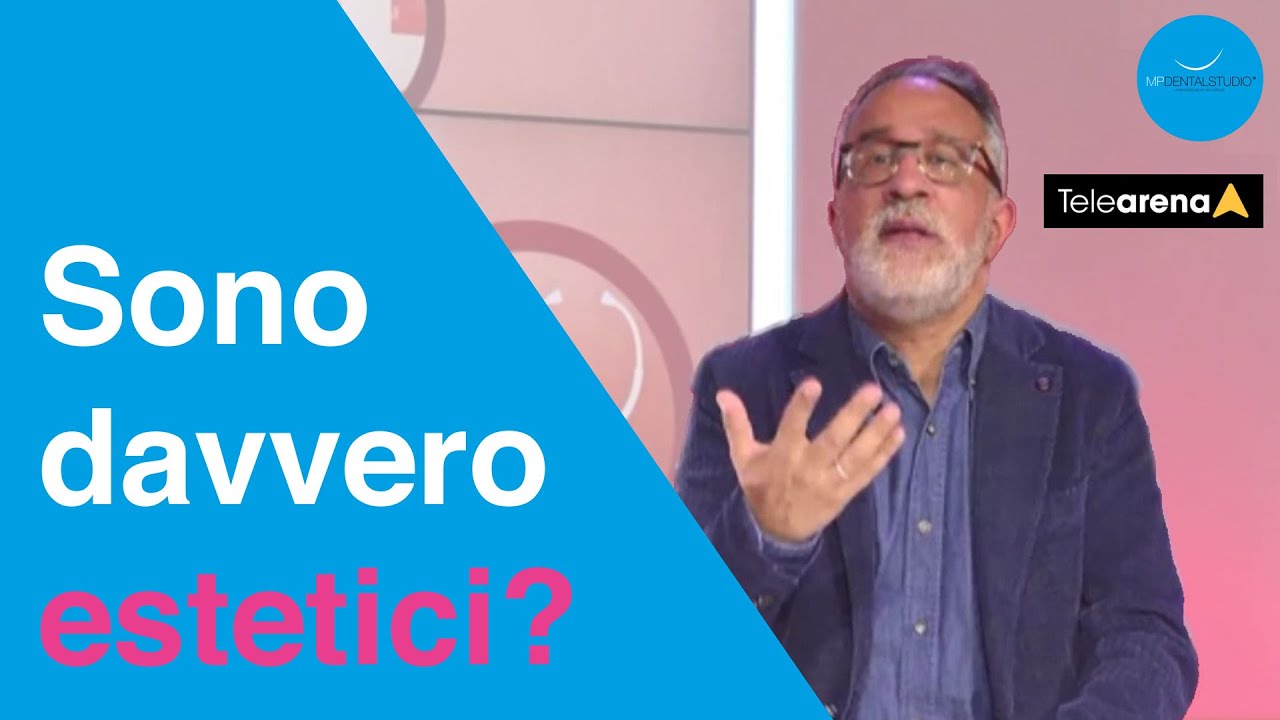 Impianti dentali anteriori: sono sempre una buona soluzione?
