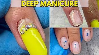 What Happens When a Manicure Goes Too Deep? Shocking Nail Damage!