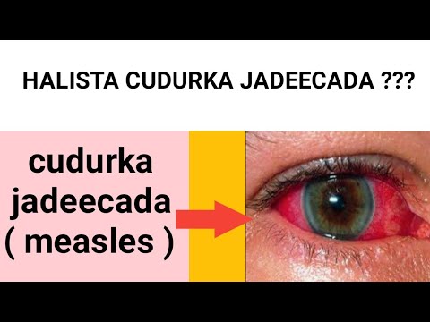 🔴 HALISTA CUDURKA JADEECADA ??? Dr-Timajilac......