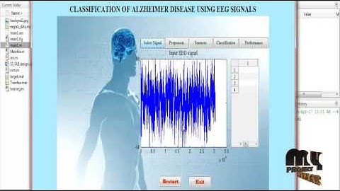 Diagnosis of Alzheimer Disease using EEG Signals | Final Year Projects 2016 - 2017