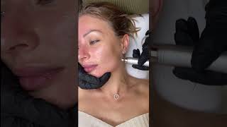 Innowacyjne Połączenie Popularnych Technologii W Zemits Verstand Hd