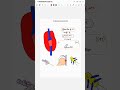 THROMBOPHLEBITIS
