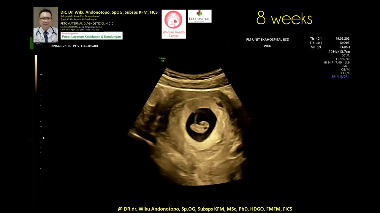 8 weeks