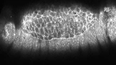 Cell Sheet Morphogenesis: Dorsal Closure in Drosophila melanogaster as a Model System: Suppl Vid 3