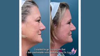 Facelift, Neck Lift & Eyelid Surgery | Dr. Lynch – Plastic Surgeons of Lexington