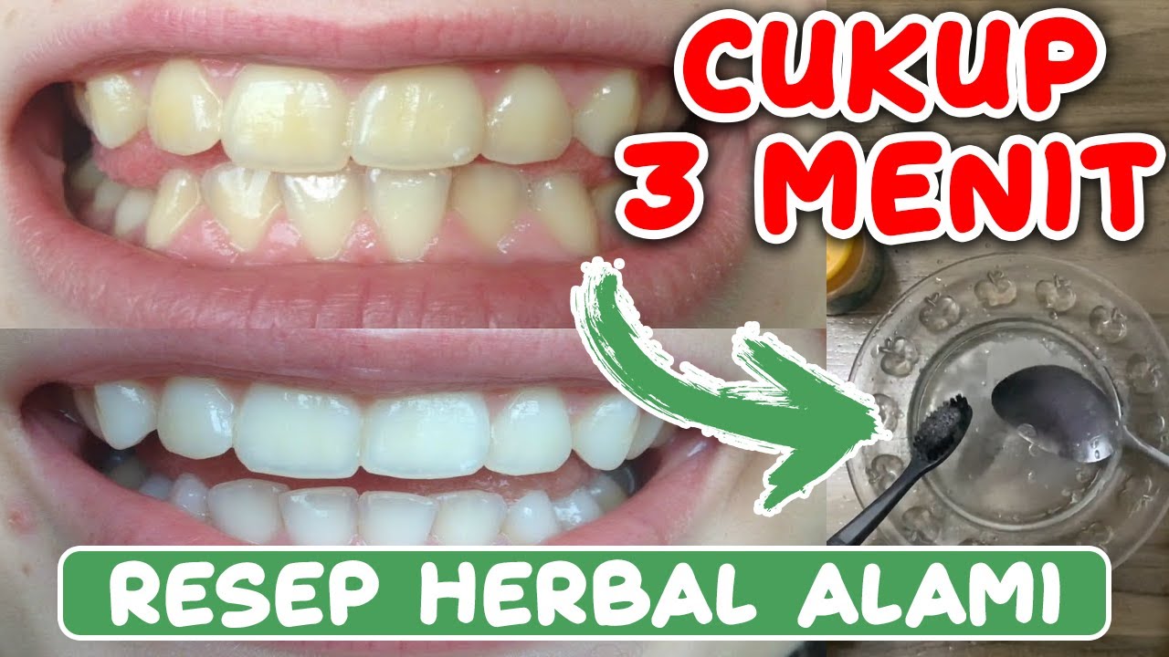 KHASIAT LEMON DAN BAKING SODA UNTUK MEMUTIHKAN GIGI SECARA ALAMI 