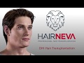 Лучшая техника трансплантации волос - DHI Трансплантация волос