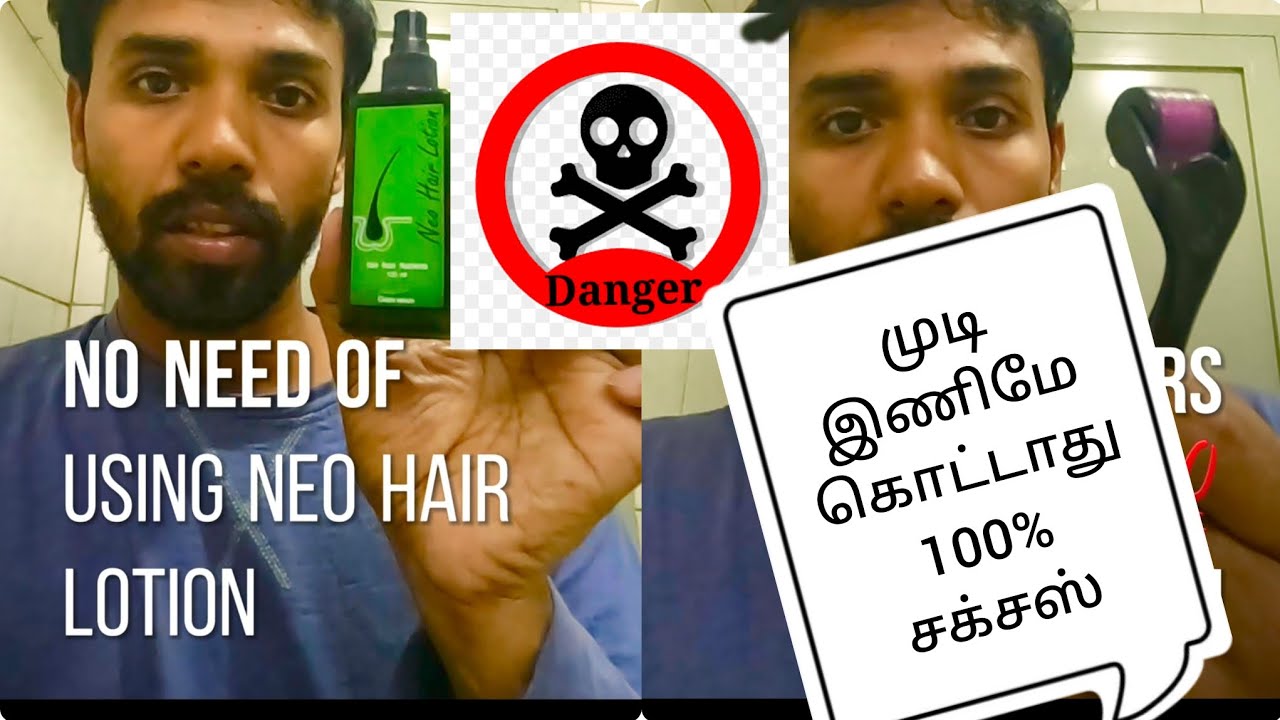 How To Use Neo Lotion side Effects Of Neo Lotion how-to-use-neo-lotion-side-effects-of-neo-lotion