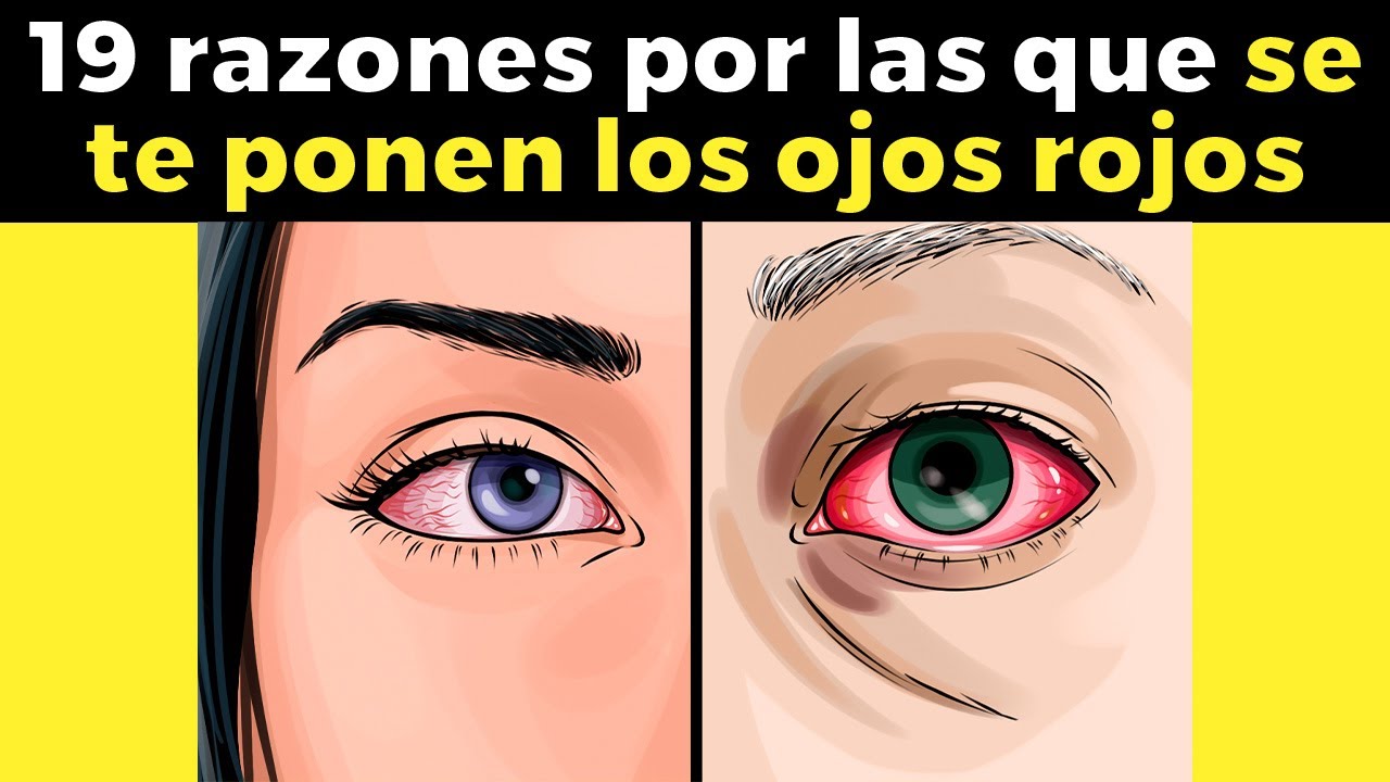 Por que pican los ojos